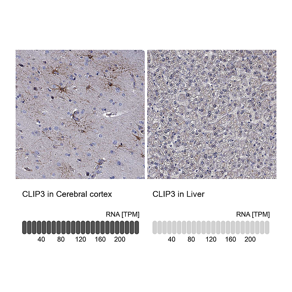 Atlas Antibodies Anti-CLIP3 Antibody
