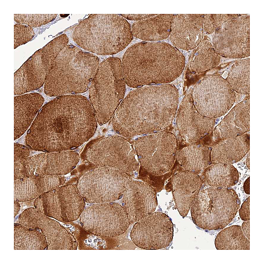 Atlas Antibodies Anti-CLIP4 Antibody