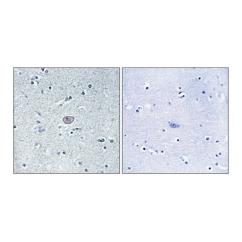 Merck Anti-VEGFR2 antibody produced in rabbit