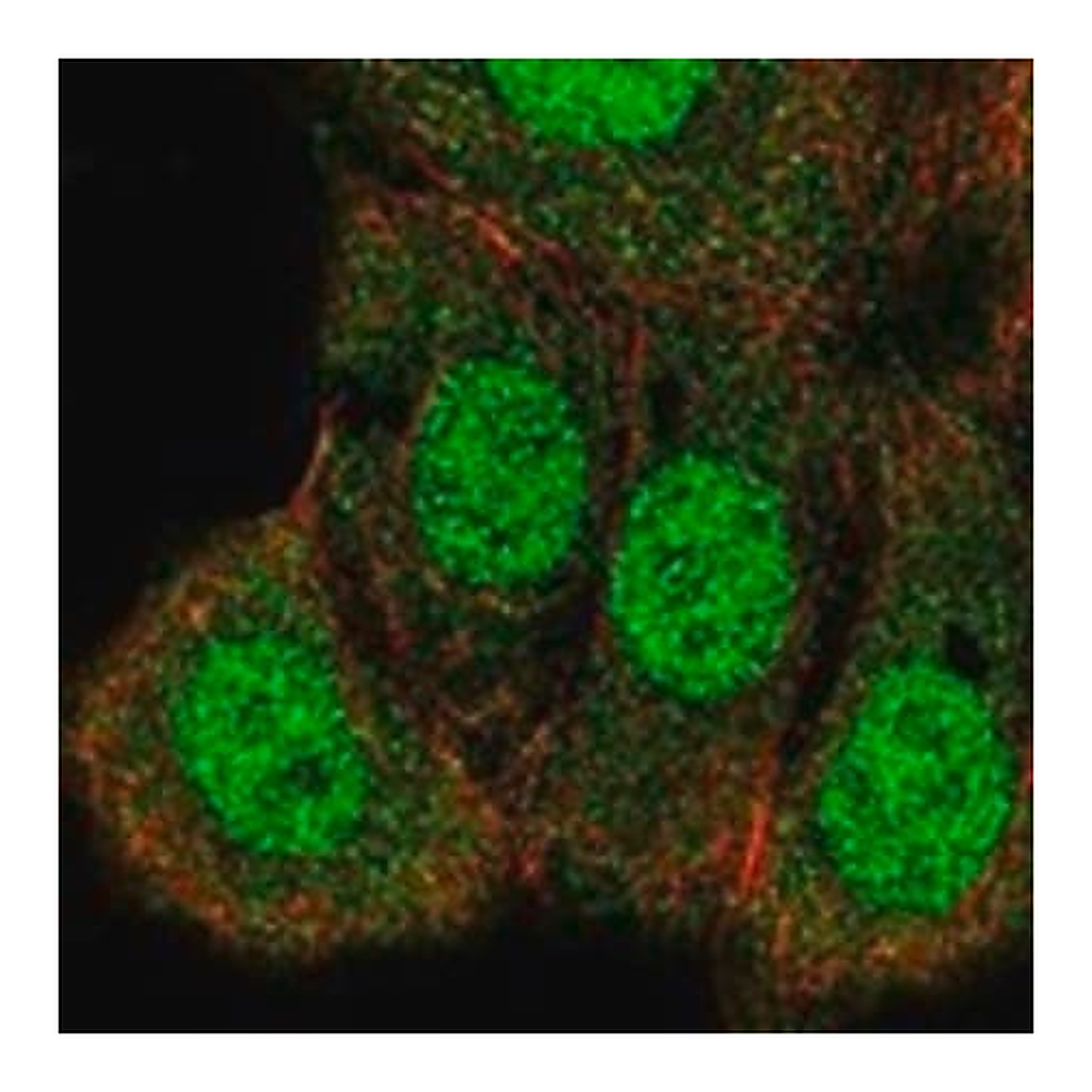 Merck Anti-HRAS antibody produced in rabbit