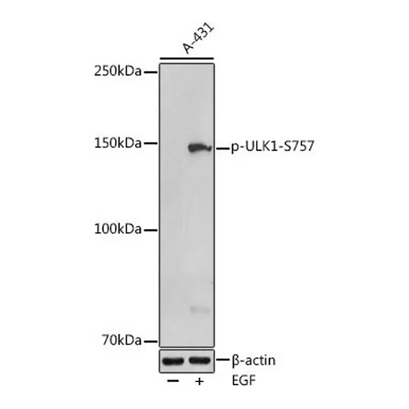 Merck Anti-Phospho-ULK1-S757 antibody produced in rabbit