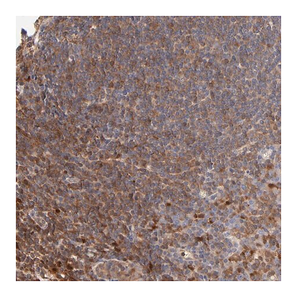 Merck Anti-ARHGEF6 antibody produced in rabbit