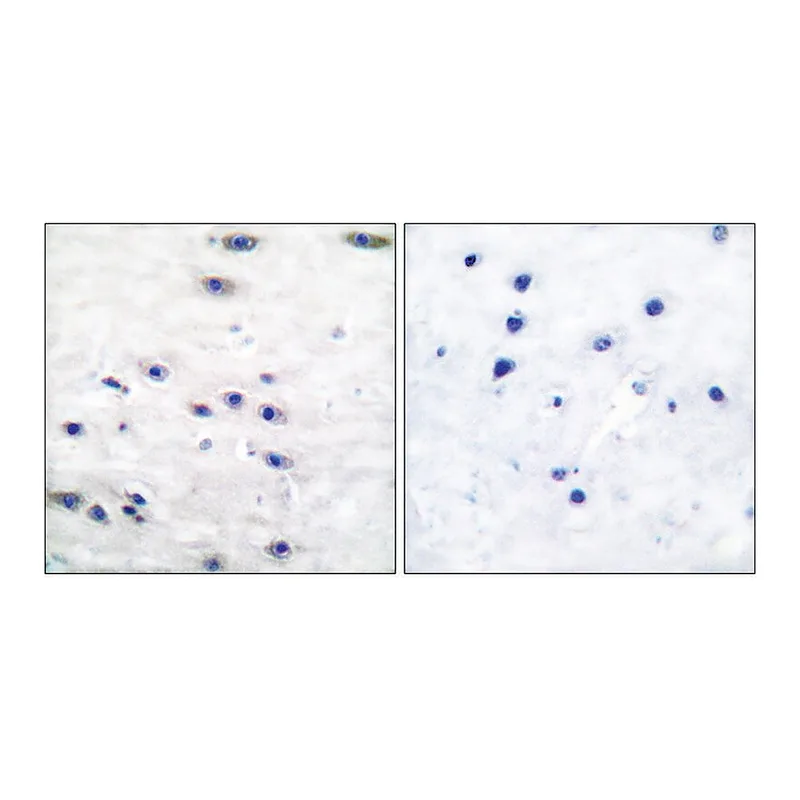 Merck Anti-Tyrosine Hydroxylase, N-Terminal antibody produced in rabbit