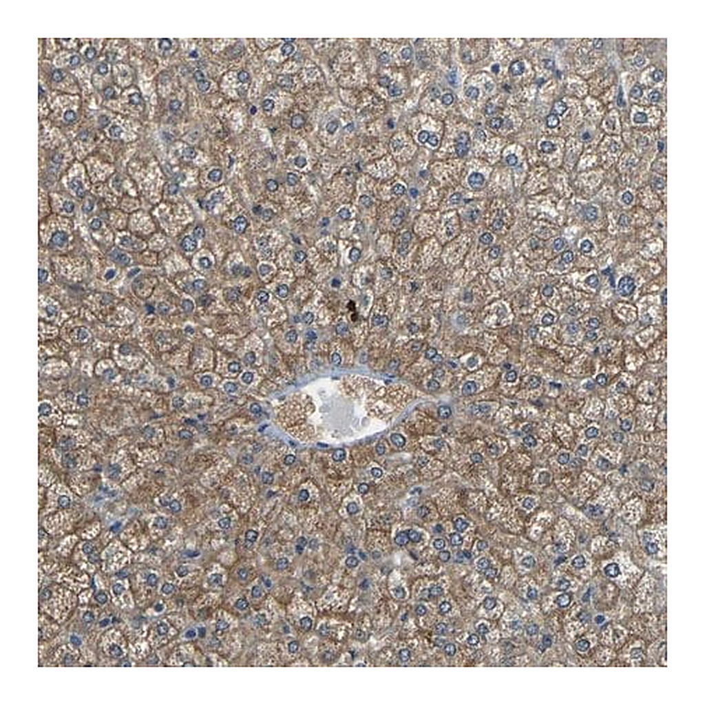 Merck Anti-CYP26B1 antibody produced in rabbit