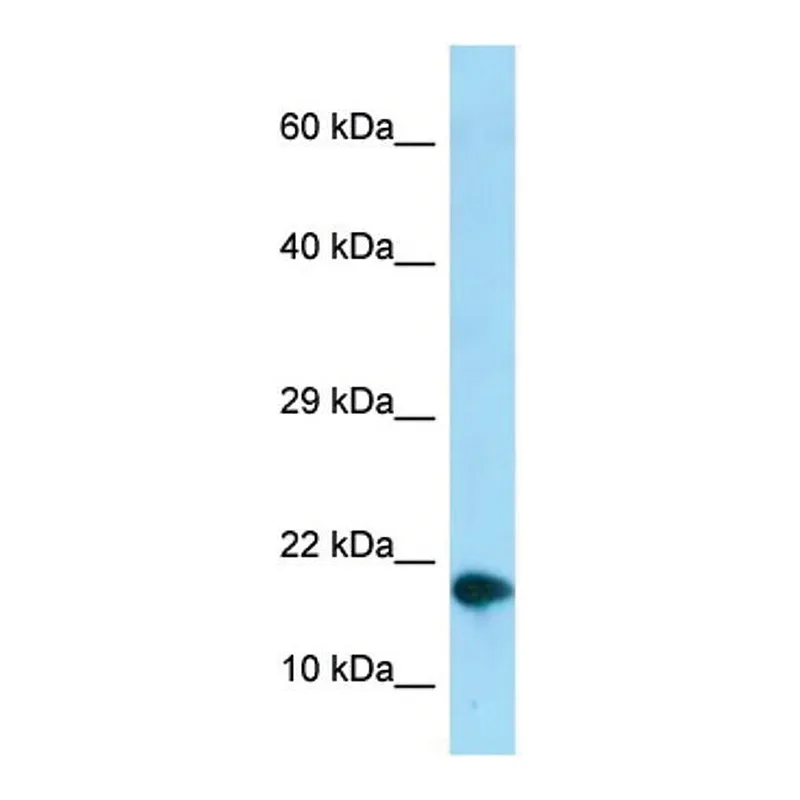 Merck ANTI-NUPR1 (C-TERMINAL) ANTIBODY PRODUCE