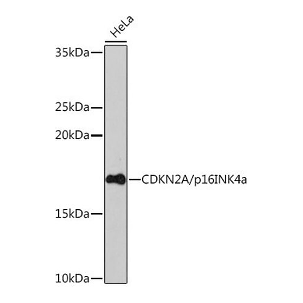 Merck Anti- CDKN2A/p16INK4a antibody produced in rabbit