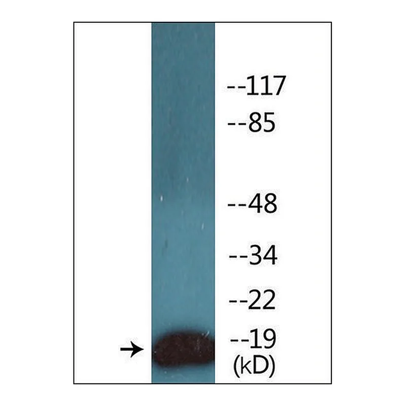 Merck Anti-phospho-CD3 zeta (pTyr142) antibody produced in rabbit