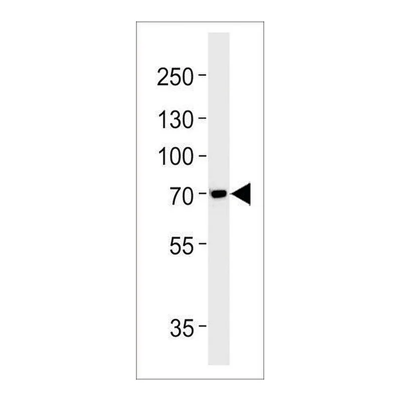 Merck ANTI-TAU (MAPT) (S720) antibody produced in rabbit
