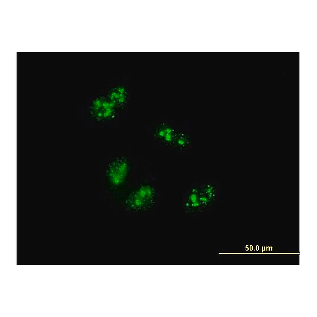 Merck Monoclonal Anti-TCOF1 antibody produced in mouse