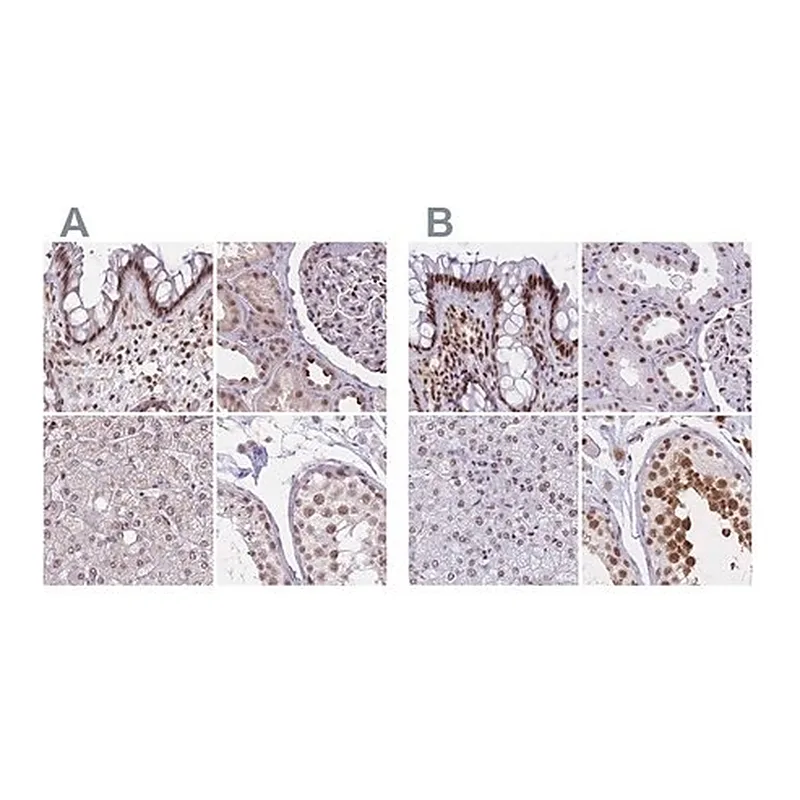 Merck Anti-HNRNPUL1 antibody produced in rabbit
