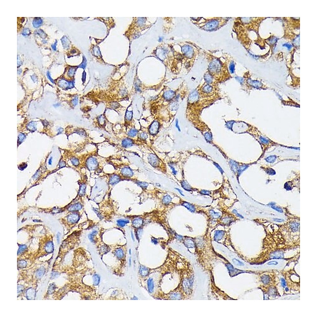 Merck Anti-RARalpha antibody produced in rabbit