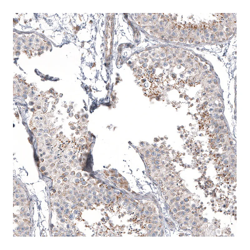 Atlas Antibodies Anti-PPM1J Antibody