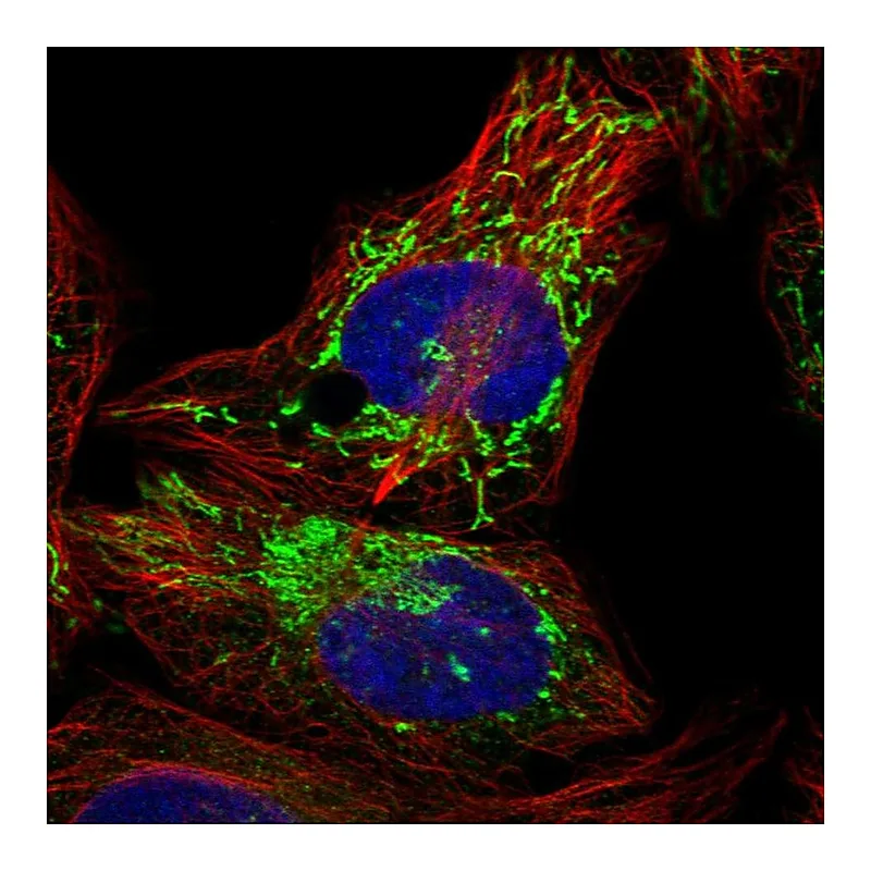 Atlas Antibodies Anti-PPM1K Antibody