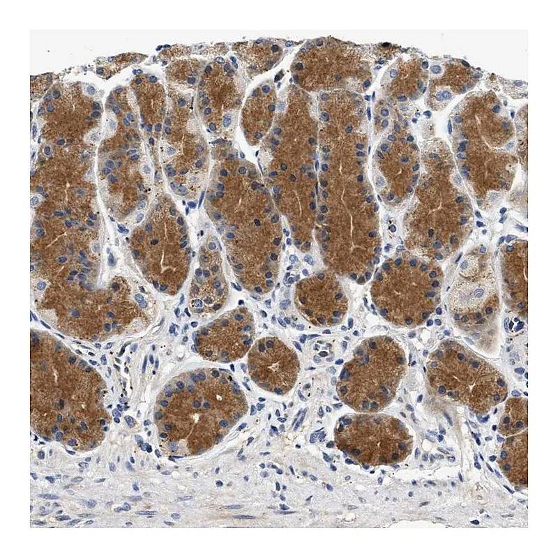 Atlas Antibodies Anti-PPM1L Antibody