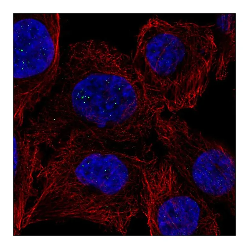 Atlas Antibodies Anti-PPM1M Antibody