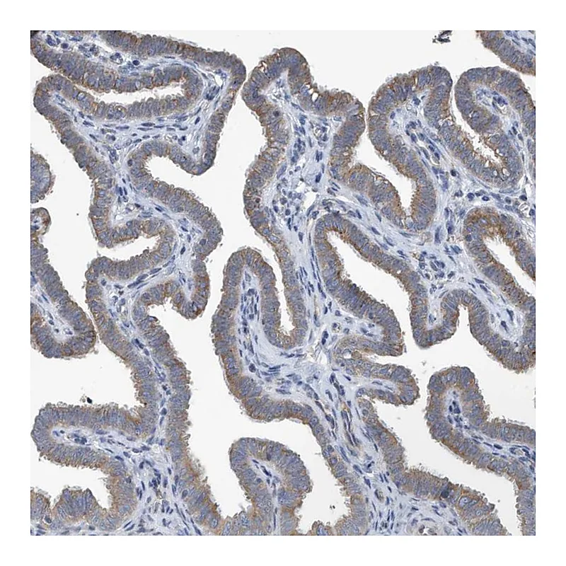 Atlas Antibodies Anti-PPM1M Antibody
