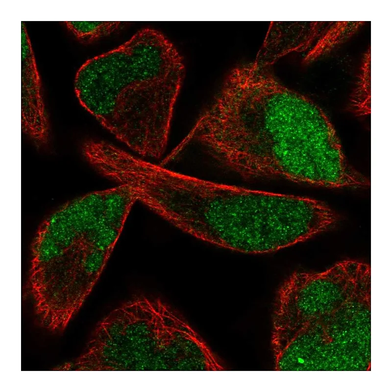 Atlas Antibodies Anti-PPME1 Antibody