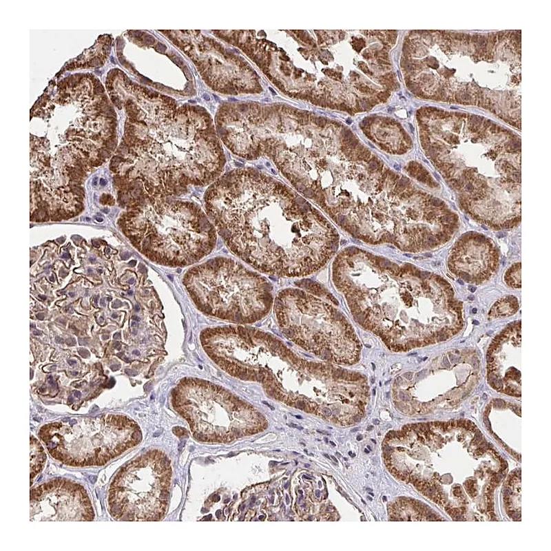 Atlas Antibodies Anti-PPP1CA Antibody