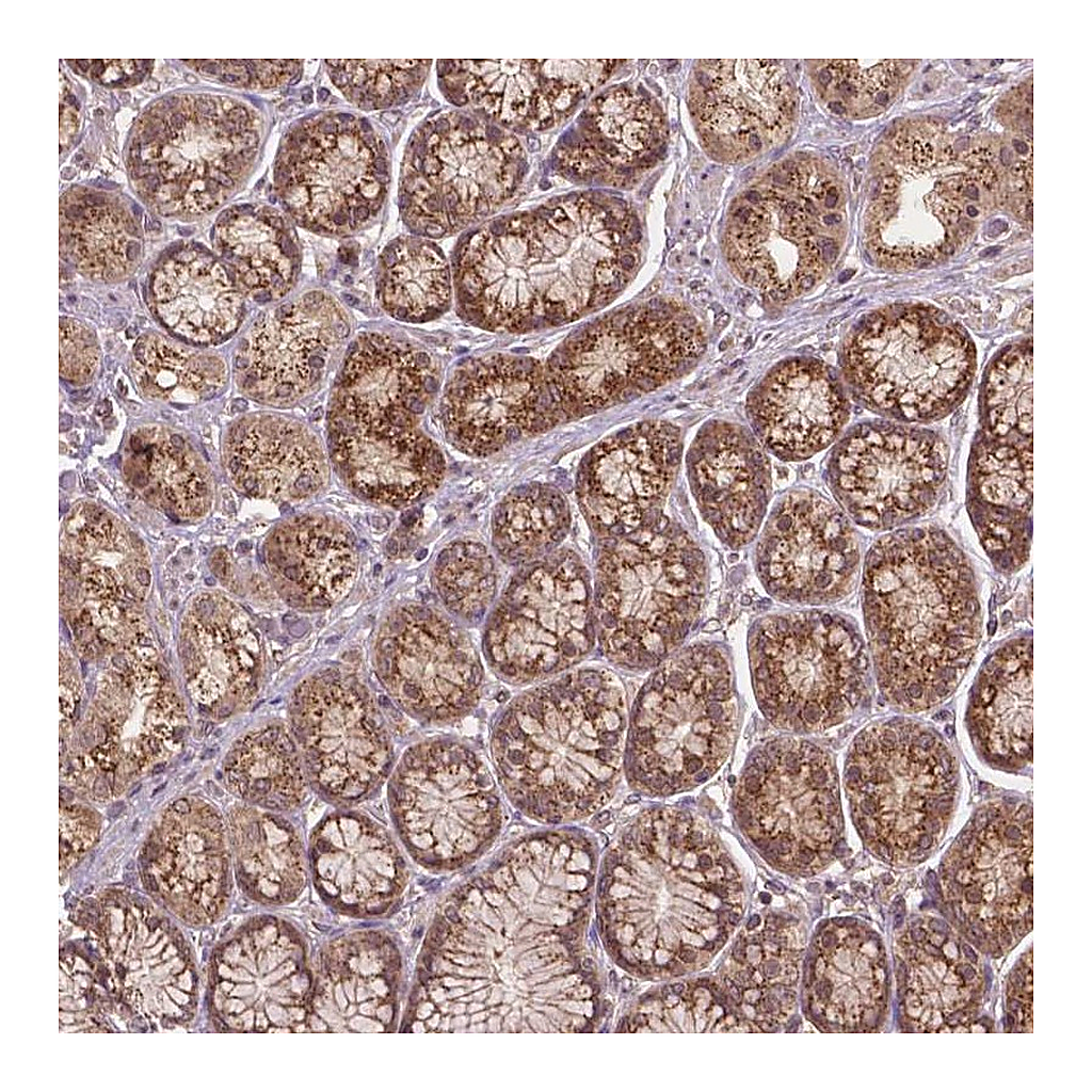 Atlas Antibodies Anti-PPP1CB Antibody