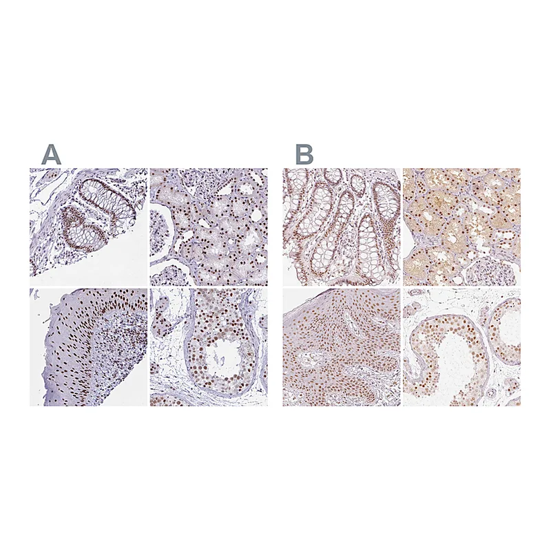 Atlas Antibodies Anti-PPP1R10 Antibody