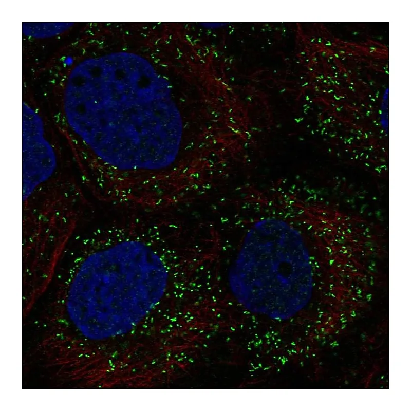 Atlas Antibodies Anti-PPP1R11 Antibody