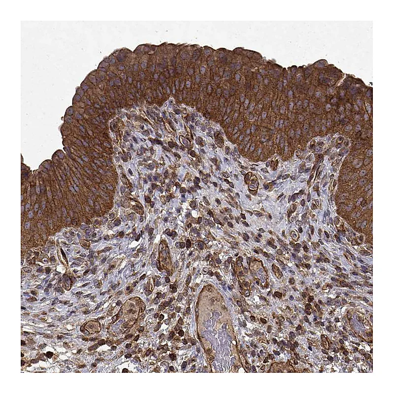 Atlas Antibodies Anti-PPP1R12A Antibody