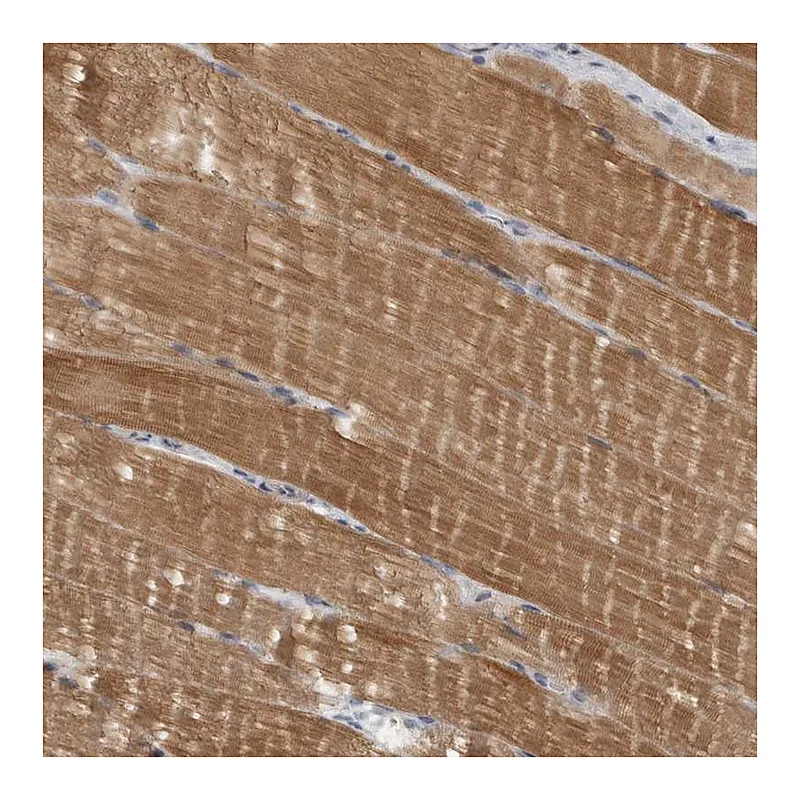 Atlas Antibodies Anti-PPP1R12B Antibody