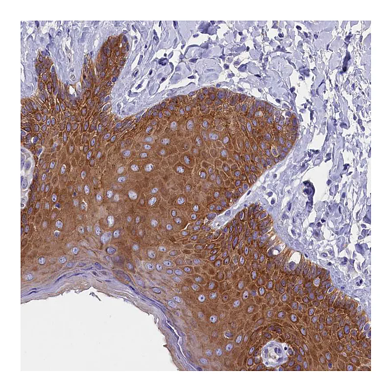 Atlas Antibodies Anti-PPP1R13L Antibody