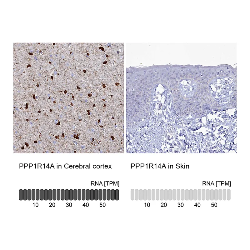 Atlas Antibodies Anti-PPP1R14A Antibody