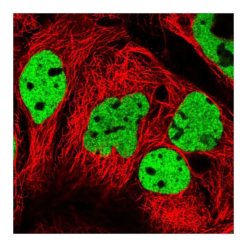 Atlas Antibodies Anti-PPP1R14A Antibody