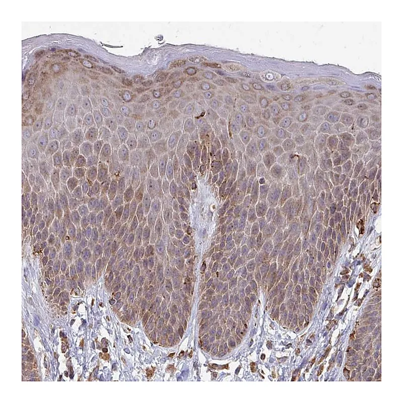 Atlas Antibodies Anti-PPP1R13L Antibody