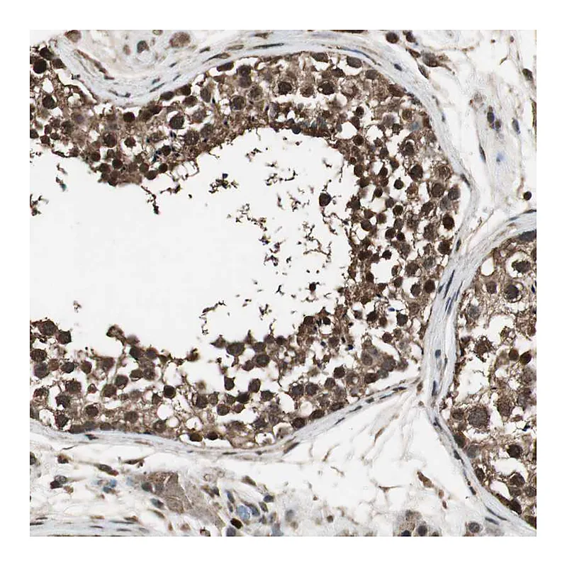 Atlas Antibodies Anti-PPP1R13B Antibody