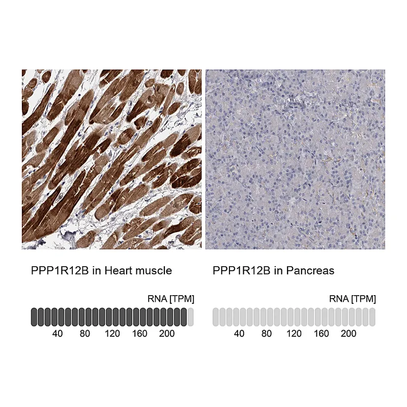 Atlas Antibodies Anti-PPP1R12B Antibody
