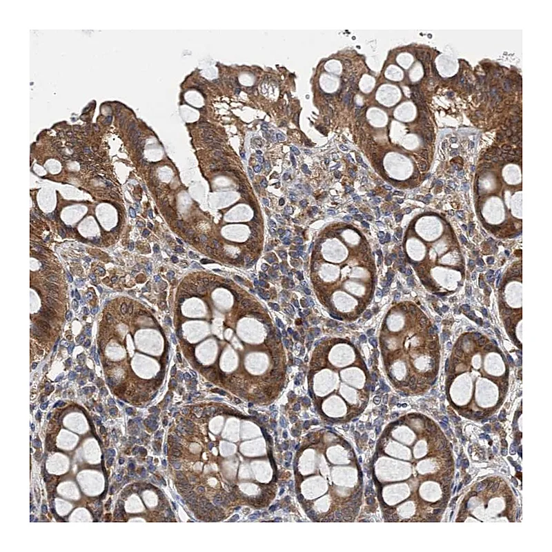 Atlas Antibodies Anti-PPP1R14D Antibody