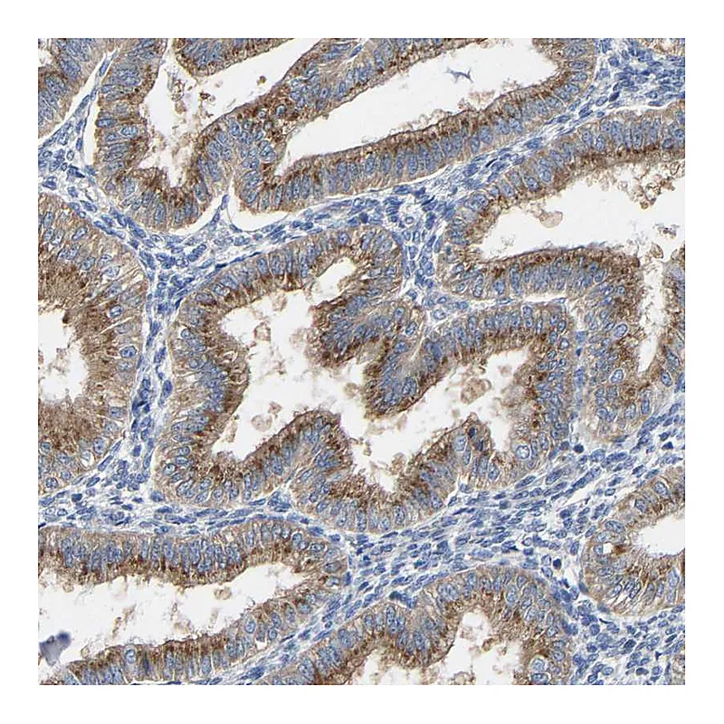 Atlas Antibodies Anti-PPP1R15A Antibody