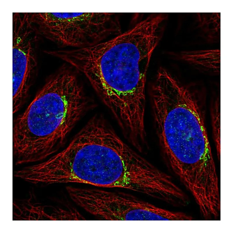 Atlas Antibodies Anti-PPP1R15B Antibody
