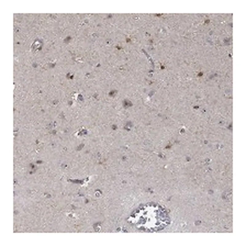 Atlas Antibodies Anti-PPP1R16B Antibody