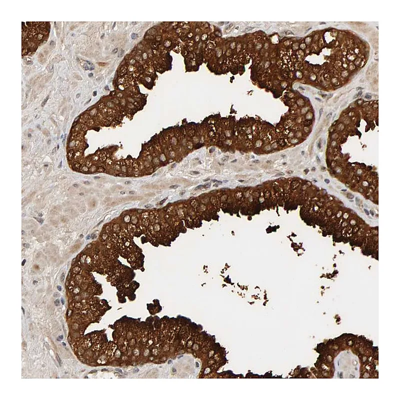 Atlas Antibodies Anti-PPP1R16A Antibody