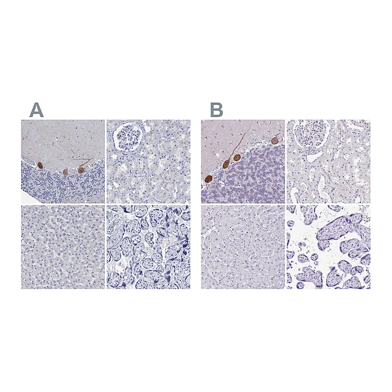Atlas Antibodies Anti-PPP1R17 Antibody