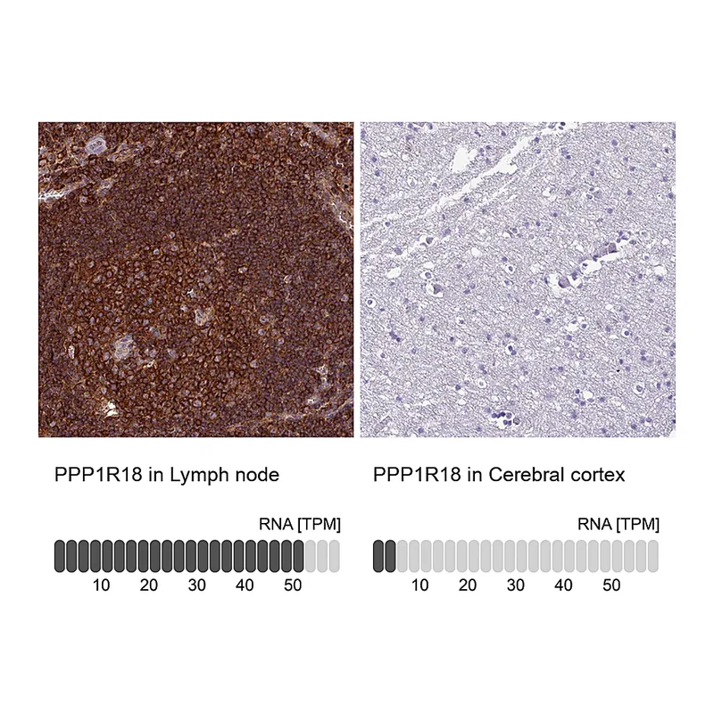 Atlas Antibodies Anti-PPP1R18 Antibody