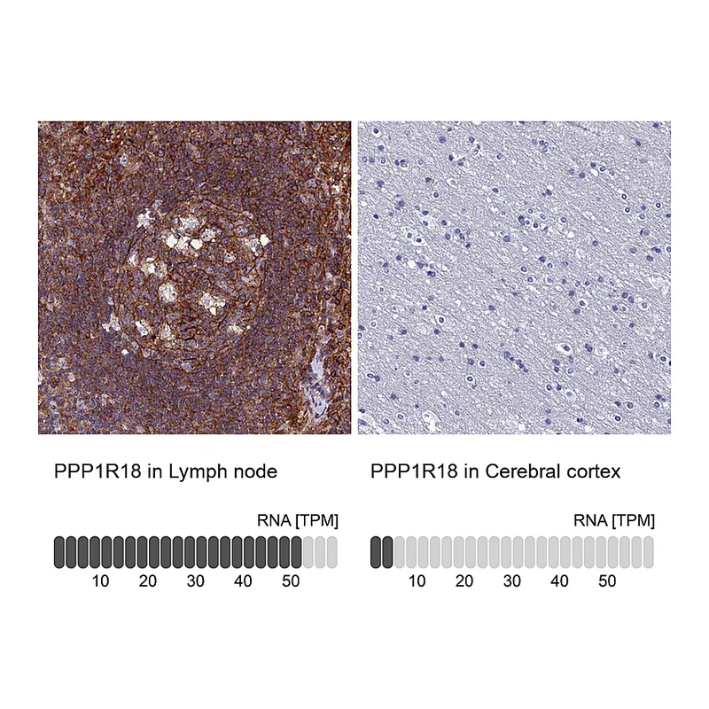 Atlas Antibodies Anti-PPP1R18 Antibody