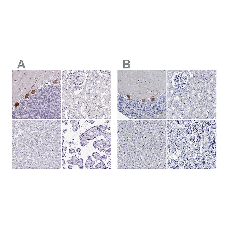 Atlas Antibodies Anti-PPP1R17 Antibody
