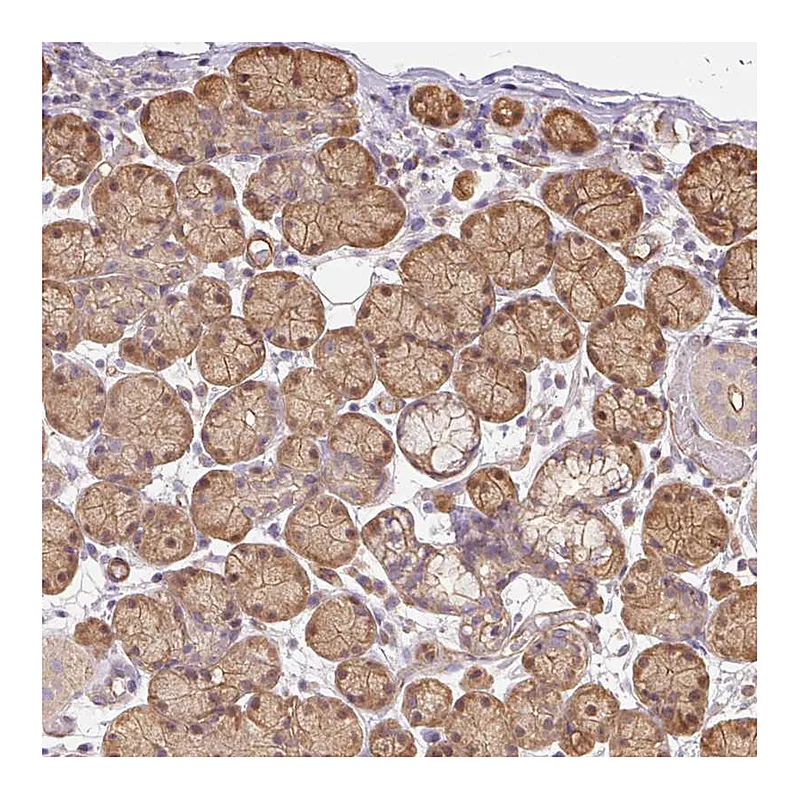 Atlas Antibodies Anti-PPP1R1B Antibody
