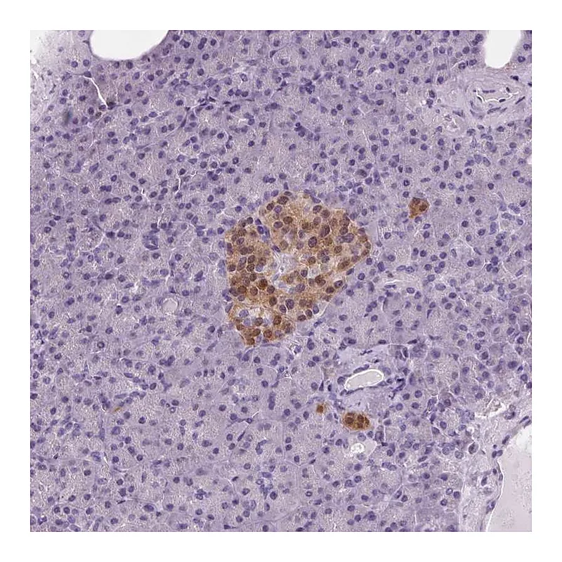 Atlas Antibodies Anti-PPP1R1A Antibody