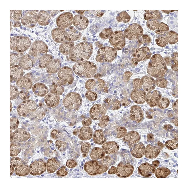 Atlas Antibodies Anti-PPP1R1B Antibody
