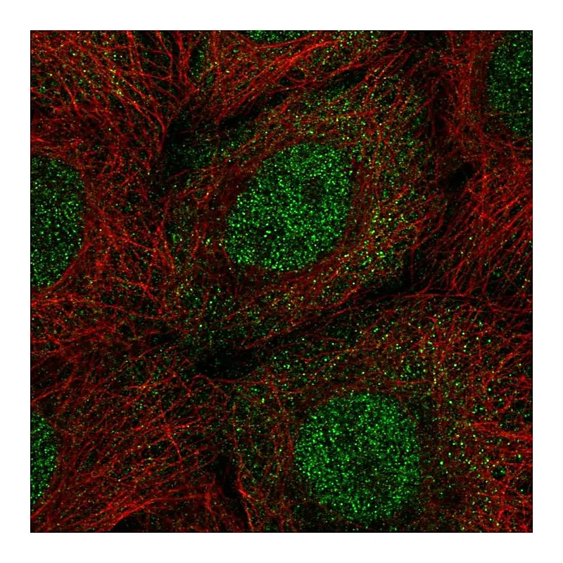 Atlas Antibodies Anti-PPP1R2 Antibody