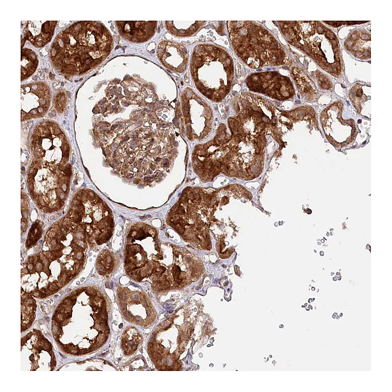Atlas Antibodies Anti-PPP1R21 Antibody