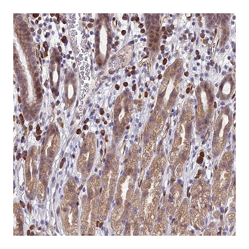 Atlas Antibodies Anti-PPP1R26 Antibody