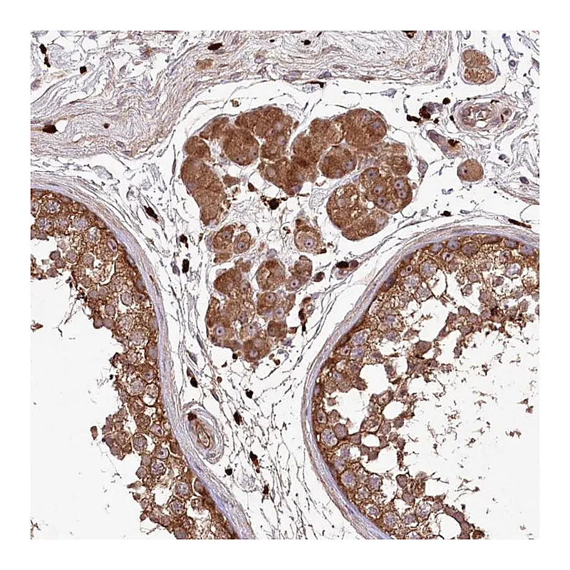 Atlas Antibodies Anti-PPP1R21 Antibody