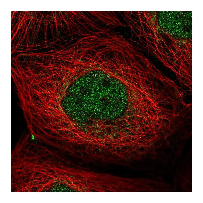 Atlas Antibodies Anti-PPP1R2 Antibody